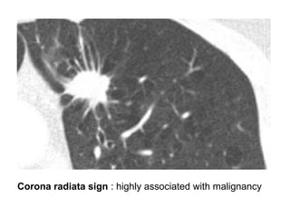 Diagnostic Imaging of Pulmonary Tumors | PPT