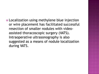 Localization using methylene blue injection or wire placement has facilitated successful resection of smaller nodules with video-assisted thoracoscopic surgery (VATS). Intraoperative ultrasonography is also suggested as a means of nodule localization during VATS.