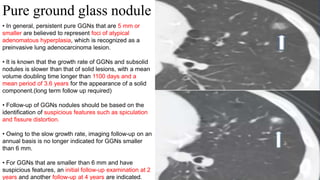 Approach to imaging of Solitary pulmonary nodule .pptx