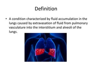 Definition
• A condition characterized by fluid accumulation in the
lungs caused by extravasation of fluid from pulmonary
vasculature into the interstitium and alveoli of the
lungs.
 