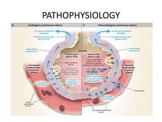 PATHOPHYSIOLOGY
 