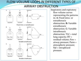 FLOW-VOLUME LOOPS IN DIFFERENT TYPES OF
AIRWAY OBSTRUCTION
Inspiratory and expiratory
flow-volume curves
representing the patterns
in: A: Fixed intra- or
extrathoracic
obstruction. B: Variable
extrathoracic
obstruction. C: Variable
intrathoracic
obstruction. TLC = total
lung capacity; RV =
residual volume; Paw =
airway pressure; Patm =
atmospheric pressure;
Ppl = intrapleural
pressure.
 