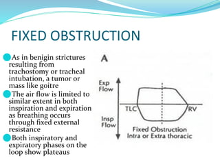 FIXED OBSTRUCTION
⚫As in benigin strictures
resulting from
trachostomy or tracheal
intubation, a tumor or
mass like goitre
⚫The air flow is limited to
similar extent in both
inspiration and expiration
as breathing occurs
through fixed external
resistance
⚫Both inspiratory and
expiratory phases on the
loop show plateaus
 