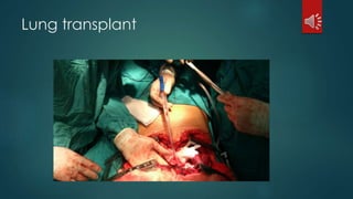 Lung transplant
 