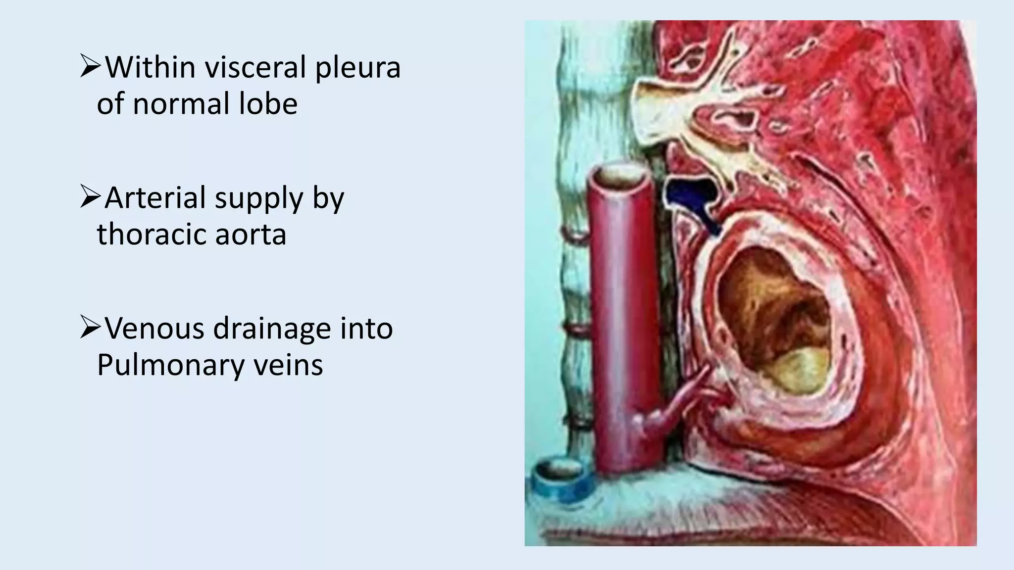 Within visceral pleura
of normal lobe
Arterial supply by
thoracic aorta
Venous drainage into
Pulmonary veins
 