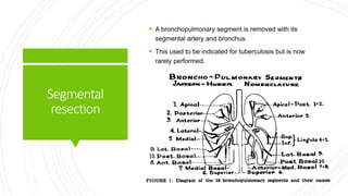 Segmental
resection
 A bronchopulmonary segment is removed with its
segmental artery and bronchus.
 This used to be indicated for tuberculosis but is now
rarely performed.
 