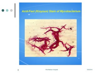 Acid-Fast (Kinyoun) Stain of Mycobacterium 