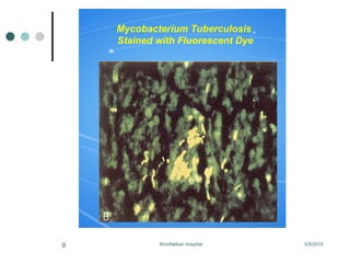 Mycobacterium Tuberculosis  Stained with Fluorescent Dye 