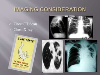  Chest CT Scan
 Chest X-ray
 
