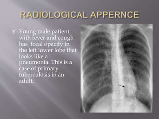  Young male patient
with fever and cough
has focal opacity in
the left lower lobe that
looks like a
pneumonia. This is a
case of primary
tuberculosis in an
adult.
 