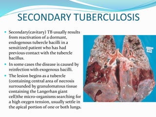 SECONDARY TUBERCULOSIS
 Secondary(cavitary) TB usually results
from reactivation of a dormant,
endogenous tubercle bacilli in a
sensitized patient who has had
previous contact with the tubercle
bacillus.
 In some cases the disease is caused by
reinfection with exogenous bacilli.
 The lesion begins as a tubercle
(containing central area of necrosis
surrounded by granulomatous tissue
containing the Langerhan giant
cell)the micro-organisms searching for
a high oxygen tension, usually settle in
the apical portion of one or both lungs.
 