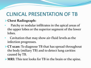 CLINICAL PRESENTATION OF TB
Chest Radiograph:
• Patchy or nodular infiltrates in the apical areas of
the upper lobes or the superior segment of the lower
lobes.
• Cavitation that may show air-fluid levels as the
infection progresses.
CT scan: To diagnose TB that has spread throughout
the body (miliary TB) and to detect lung cavities
caused by TB.
MRI: This test looks for TB in the brain or the spine.
 
