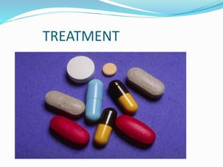 TREATMENT
 
