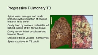 Progressive Pulmonary TB
Apical lesion enlarges and erode
bronchus with evacuation of necrotic
material in its lumen
Cavity lined by caseous material is left
behind, walled off by fibrous tissue
Cavity remain intact or collapse and
become fibrotic
Erosion of blood vessels - hemoptysis
Sputum positive for TB bacilli
 