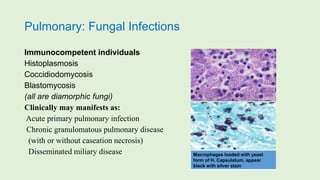 Pulmonary: Fungal Infections
Immunocompetent individuals
Histoplasmosis
Coccidiodomycosis
Blastomycosis
(all are diamorphic fungi)
Clinically may manifests as:
Acute primary pulmonary infection
Chronic granulomatous pulmonary disease
(with or without caseation necrosis)
Disseminated miliary disease Macrophages loaded with yeast
form of H. Capsulatum, appear
black with silver stain
 