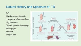Natural History and Spectrum of TB
C/F
May be asymptomatic
Low grade afternoon fever
Night sweats
Chronic productive cough
Hemoptysis
Anemia
Weight loss
 