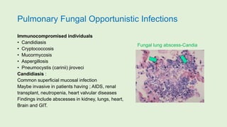 Pulmonary Fungal Opportunistic Infections
Immunocompromised individuals
• Candidiasis
• Cryptococcosis
• Mucormycosis
• Aspergillosis
• Pneumocystis (carinii) jiroveci
Candidiasis :
Common superficial mucosal infection
Maybe invasive in patients having ; AIDS, renal
transplant, neutropenia, heart valvular diseases
Findings include abscesses in kidney, lungs, heart,
Brain and GIT.
Fungal lung abscess-Candia
 
