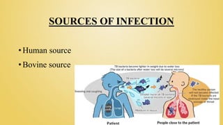 SOURCES OF INFECTION
• Human source
• Bovine source
 
