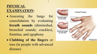 .
PHYSICAL
EXAMINATION-
 Assessing the lungs for
consolidation by evaluating
breath sounds (diminished,
bronchial sounds; crackles),
fremitus, and egophony
 Clubbing of the fingers or
toes (in people with advanced
disease)
 