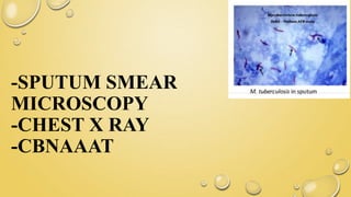 -SPUTUM SMEAR
MICROSCOPY
-CHEST X RAY
-CBNAAAT
 