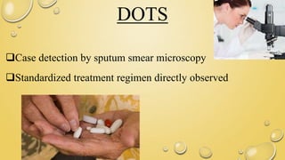 DOTS
Case detection by sputum smear microscopy
Standardized treatment regimen directly observed
 