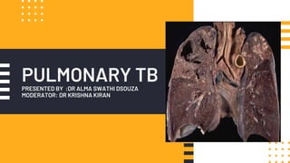 PULMONARY TB
PRESENTED BY :DR ALMA SWATHI DSOUZA
MODERATOR: DR KRISHNA KIRAN
 