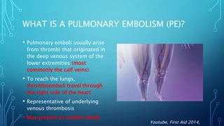 WHAT IS A PULMONARY EMBOLISM (PE)?
• Pulmonary emboli usually arise
from thrombi that originated in
the deep venous system of the
lower extremities (most
commonly the calf veins)
• To reach the lungs,
thromboemboli travel through
the right side of the heart
• Representative of underlying
venous thrombosis
• May present as sudden death
Youtube, First Aid 2014,
 