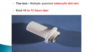 Tine Multiple Tuberclasis | PPTX