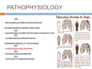 PATHOPHYSIOLOGY
 THE MATERIAL (BACTERIA AND MACROPHAGES
BECOMES NECROTIC FORMING CHEESY MASS
 MASS BECOMES CALCIFIED AND BECOMES COLAGENOUS SCAR
 BACTERIA BECOME DORMANT AND NO
FURTHER PROGRESSION OF ACTIVE DISEASE
 (ACTIVE DISEASE OR RE INFECTION)
 INADEQUATE IMMUNE RESPONSE
 ACTIVATION OF DORMANT BACTERIA
 
