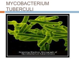 MYCOBACTERIUM
TUBERCULI
 