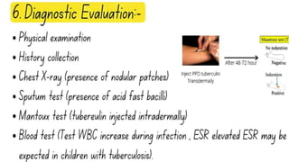 PULMONARY TUBERCULOSIS SLIDESHARE 
