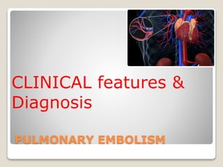 PULMONARY EMBOLISM
CLINICAL features &
Diagnosis
 