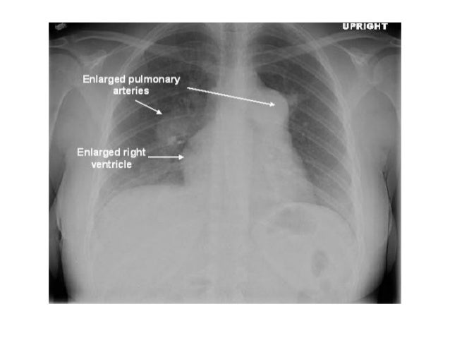 Diagnostic Imaging of Pulmonary Vasculature
