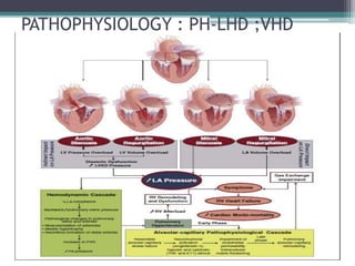 PATHOPHYSIOLOGY : PH-LHD ;VHD
 