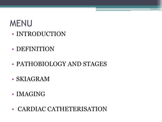 MENU
• INTRODUCTION
• DEFINITION
• PATHOBIOLOGY AND STAGES
• SKIAGRAM
• IMAGING
• CARDIAC CATHETERISATION
 