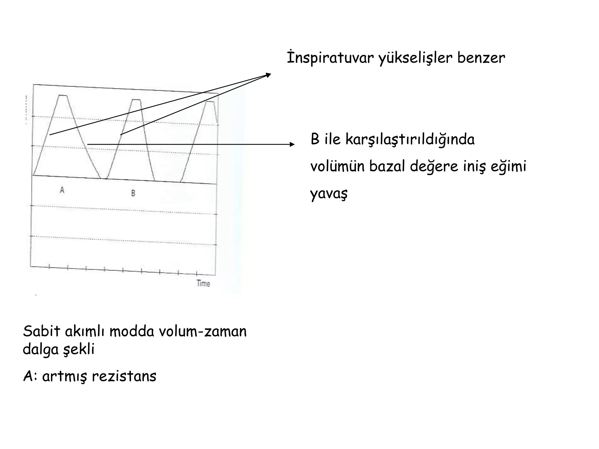 Sabit akımlı modda volum-zaman
dalga şekli
A: artmış rezistans
İnspiratuvar yükselişler benzer
B ile karşılaştırıldığında
volümün bazal değere iniş eğimi
yavaş
 