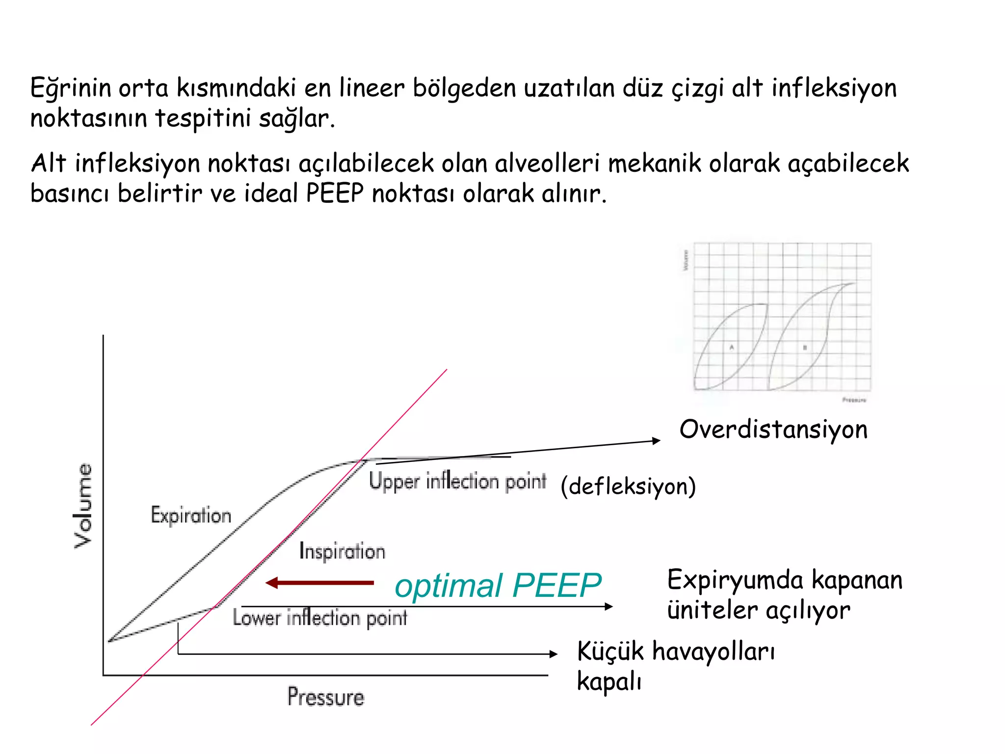 Eğrinin orta kısmındaki en lineer bölgeden uzatılan düz çizgi alt infleksiyon
noktasının tespitini sağlar.
Alt infleksiyon noktası açılabilecek olan alveolleri mekanik olarak açabilecek
basıncı belirtir ve ideal PEEP noktası olarak alınır.
Expiryumda kapanan
üniteler açılıyor
Overdistansiyon
optimal PEEP
Küçük havayolları
kapalı
(defleksiyon)
 
