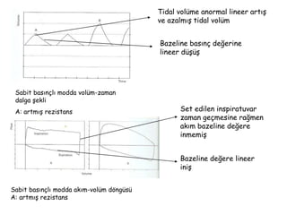 Sabit basınçlı modda volüm-zaman
dalga şekli
A: artmış rezistans
Tidal volüme anormal lineer ış
ve azalmış tidal volüm
Bazeline basınç değerine
lineer düşüş
Sabit basınçlı modda akım-volüm döngüsü
A: artmış rezistans
Set edilen inspiratuvar
zaman geçmesine rağmen
akım bazeline değere
inmemiş
Bazeline değere lineer
iniş
 