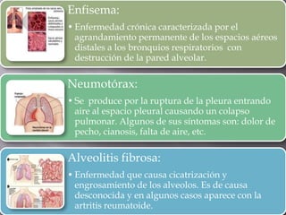 Enfisema:
• Enfermedad crónica caracterizada por el
agrandamiento permanente de los espacios aéreos
distales a los bronquios respiratorios con
destrucción de la pared alveolar.
Neumotórax:
• Se produce por la ruptura de la pleura entrando
aire al espacio pleural causando un colapso
pulmonar. Algunos de sus síntomas son: dolor de
pecho, cianosis, falta de aire, etc.
Alveolitis fibrosa:
• Enfermedad que causa cicatrización y
engrosamiento de los alveolos. Es de causa
desconocida y en algunos casos aparece con la
artritis reumatoide.
 