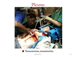 Pleuras Toracotomía, resucitación. 
agosto 2012. 
53  