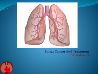 Lungs Cancer And Treatment
DR. Mohan KT
 