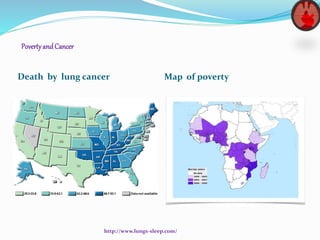 PovertyandCancer
Death by lung cancer Map of poverty
http://www.lungs-sleep.com/
 