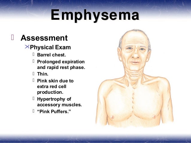 Pulmonology (resp emerg)