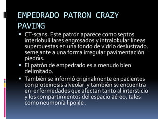 EMPEDRADO PATRON CRAZY
PAVING
 CT-scans. Este patrón aparece como septos
  interlobulillares engrosados ​y intralobular l...