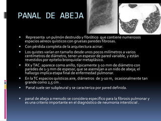PANAL DE ABEJA

    Representa un pulmón destruido y fibrótico que contiene numerosos
    espacios aéreos quísticos con gruesas paredes fibrosas.
   Con pérdida completa de la arquitectura acinar.
   Los quistes varían en tamaño desde unos pocos milímetros a varios
    centímetros de diámetro, tener un espesor de pared variable, y están
    revestidos por epitelio bronquiolar metaplásico.
   RX y TAC :aparece como anillo, típicamente 3-10 mm de diámetro con
    paredes de 1-3 mm de espesor, que se asemejan a un nido de abeja; el
    hallazgo implica etapa final de enfermedad pulmonar.
   En la TC espacios quísticos aire, diámetros de 3-10 m, ocasionalmente tan
    grande como 2,5 cm .
    Panal suele ser subpleural y se caracteriza por pared definida.

   panal de abeja a menudo se considera específico para la fibrosis pulmonar y
    es una criterio importante en el diagnóstico de neumonía intersticial .
 