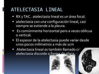 ATELECTASIA LINEAL
 RX y TAC . atelectasia lineal es un área focal.
 atelectasia con una configuración lineal, casi
  siempre se extiende a la pleura.
 Es comúnmente horizontal pero a veces oblicua
  o vertical.
 El espesor de la atelectasia puede variar desde
  unos pocos milímetros a más de 1cm
 Atelectasia lineal es también llamado como
  atelectasia discoide o forma de placa.
 