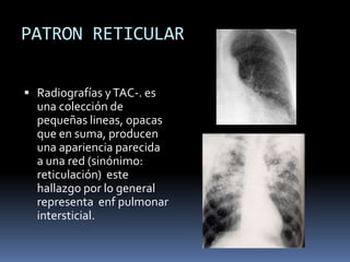 PATRON RETICULAR

 Radiografías y TAC-. es
  una colección de
  pequeñas lineas, opacas
  que en suma, producen
  una apariencia parecida
  a una red (sinónimo:
  reticulación) este
  hallazgo por lo general
  representa enf pulmonar
  intersticial.
 
