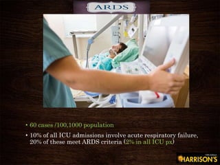 • 60 cases /100,1000 population
• 10% of all ICU admissions involve acute respiratory failure,
20% of these meet ARDS criteria (2% in all ICU px)
 