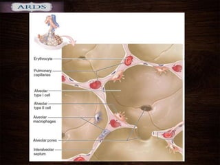 Respiratory Membrane
 