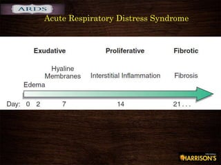 Acute Respiratory Distress Syndrome
 